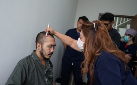 Farmanina Clinic Punya Jurus Sakti Atasi Kebotakan, Mau Tau?